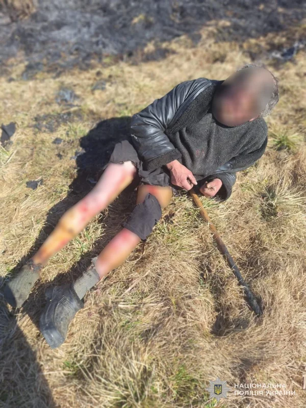 Трагічна втрата у Львові: троє пацієнтів померли в лікарні, оприлюднено шокуючі фото